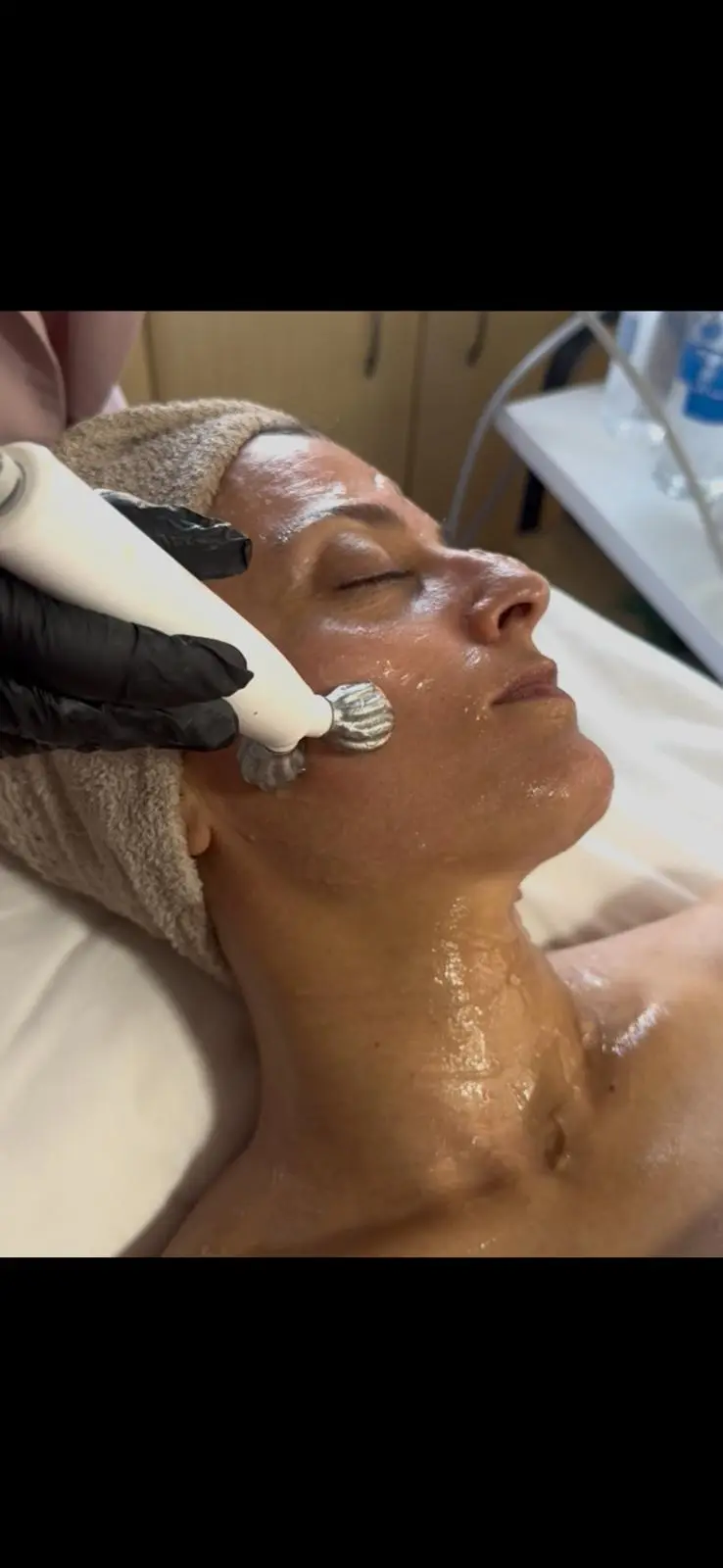 Primer plano de un tratamiento de rejuvenecimiento facial con tecnología avanzada en el centro de estética Alma Belleza en Purias, Lorca.